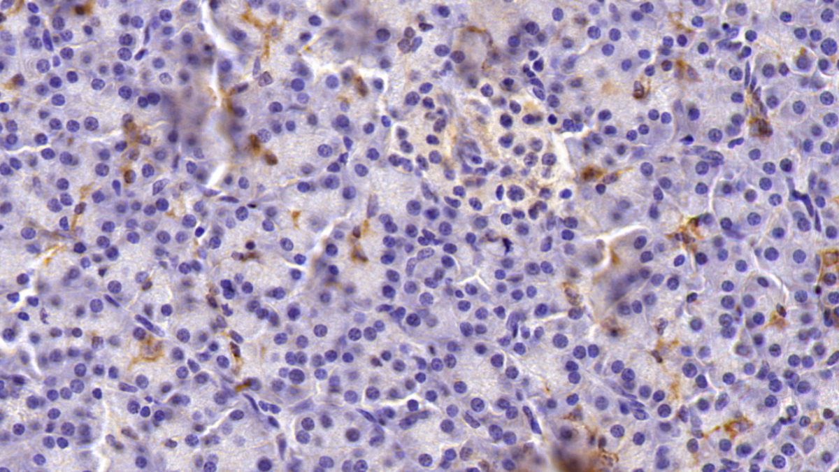 Monoclonal Antibody to Cytokeratin 19 (CK19)