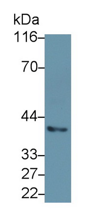 Monoclonal Antibody to Cytokeratin 19 (CK19)