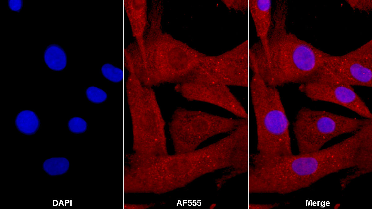 Monoclonal Antibody to Cytokeratin 19 (CK19)