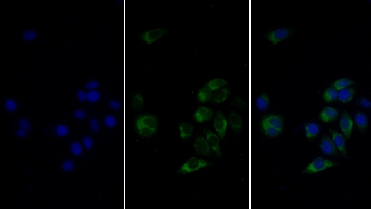 Monoclonal Antibody to Heart-type Fatty Acid Binding Protein (H-FABP)