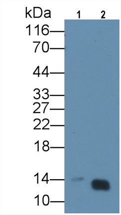 Monoclonal Antibody to Heart-type Fatty Acid Binding Protein (H-FABP)