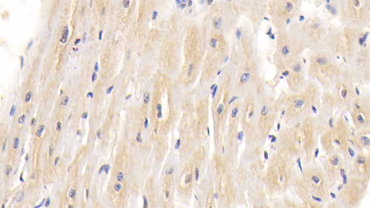 Monoclonal Antibody to Heart-type Fatty Acid Binding Protein (H-FABP)