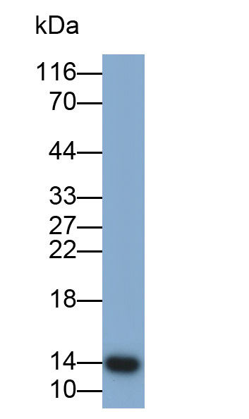 Monoclonal Antibody to Heart-type Fatty Acid Binding Protein (H-FABP)