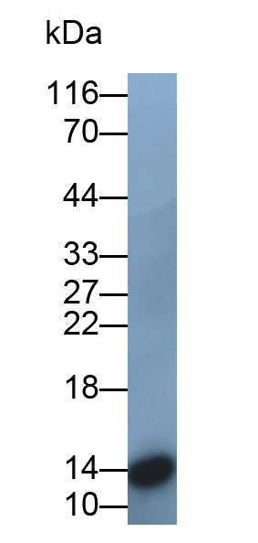 Monoclonal Antibody to Heart-type Fatty Acid Binding Protein (H-FABP)