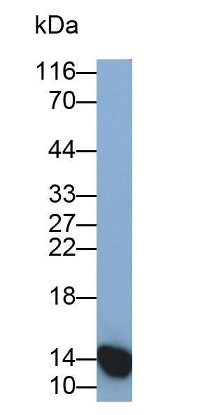 Monoclonal Antibody to Heart-type Fatty Acid Binding Protein (H-FABP)