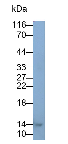 Monoclonal Antibody to Heart-type Fatty Acid Binding Protein (H-FABP)