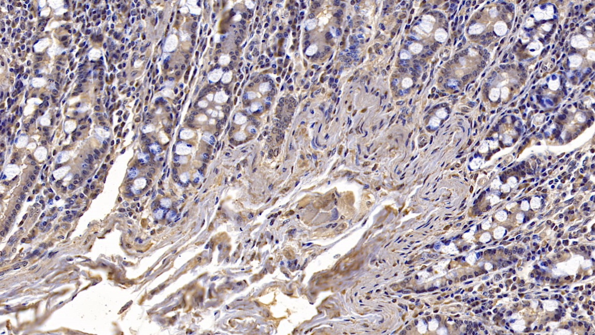 Monoclonal Antibody to Cluster Of Differentiation 73 (CD73)