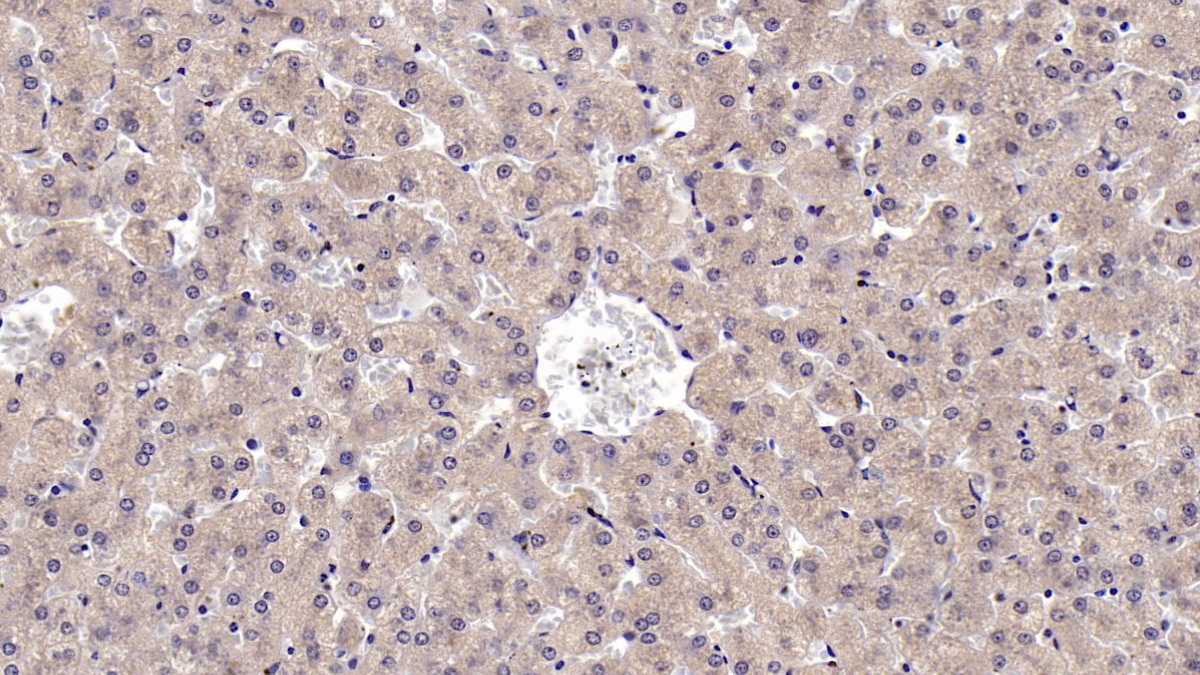 Monoclonal Antibody to Cluster Of Differentiation 73 (CD73)