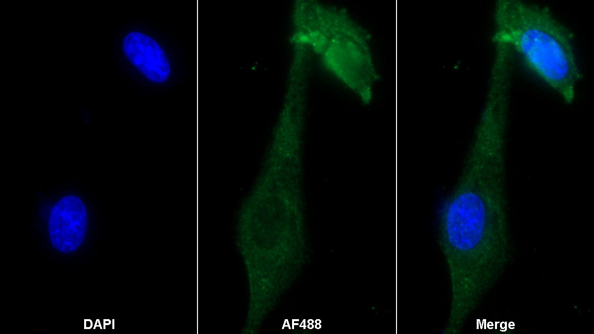 Monoclonal Antibody to Cluster Of Differentiation 73 (CD73)