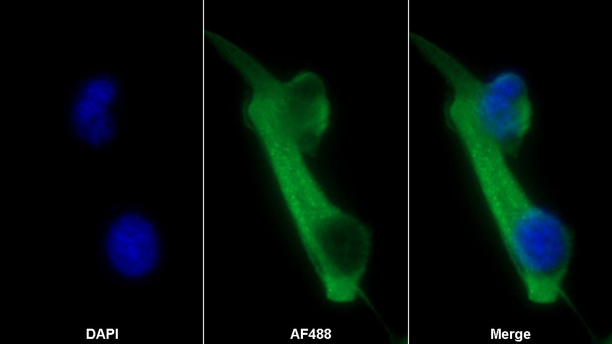 Monoclonal Antibody to Cluster Of Differentiation 73 (CD73)