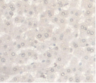 Monoclonal Antibody to Androgen Receptor (AR)