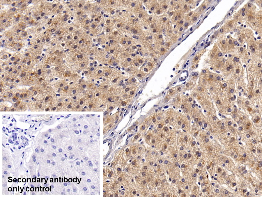 Monoclonal Antibody to Angiostatin (ANG)