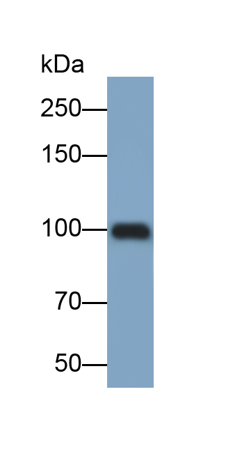 Monoclonal Antibody to Integrin Beta 3 (ITGb3)