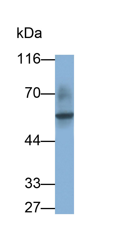 Monoclonal Antibody to Fc Fragment Of IgG Low Affinity IIIa Receptor (FcgR3A)