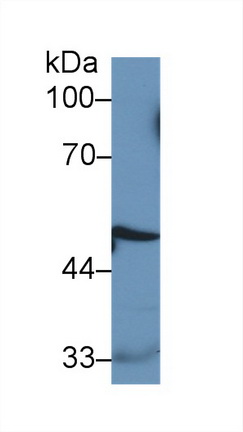 Monoclonal Antibody to Cathepsin D (CTSD)