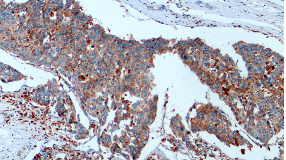 Monoclonal Antibody to Cathepsin D (CTSD)