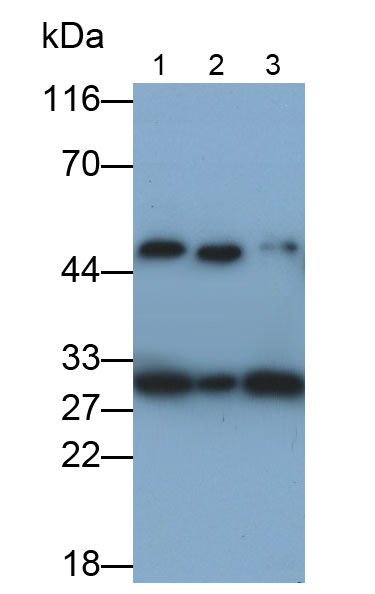 Monoclonal Antibody to Cathepsin D (CTSD)