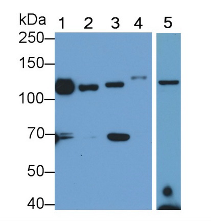 Monoclonal Antibody to Integrin Alpha V (ITGaV)