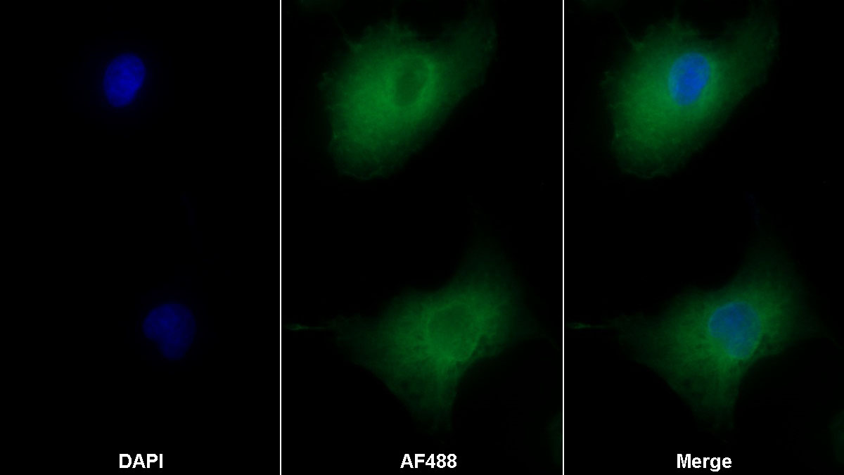 Monoclonal Antibody to Integrin Alpha V (ITGaV)