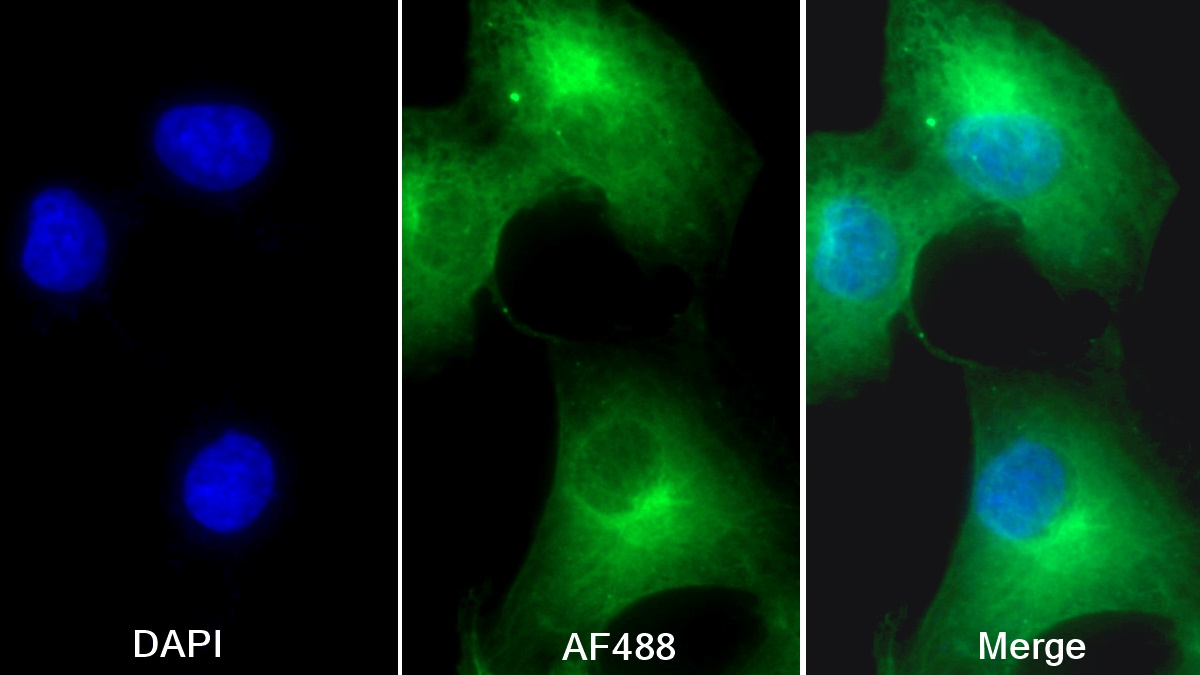 Monoclonal Antibody to Integrin Alpha V (ITGaV)