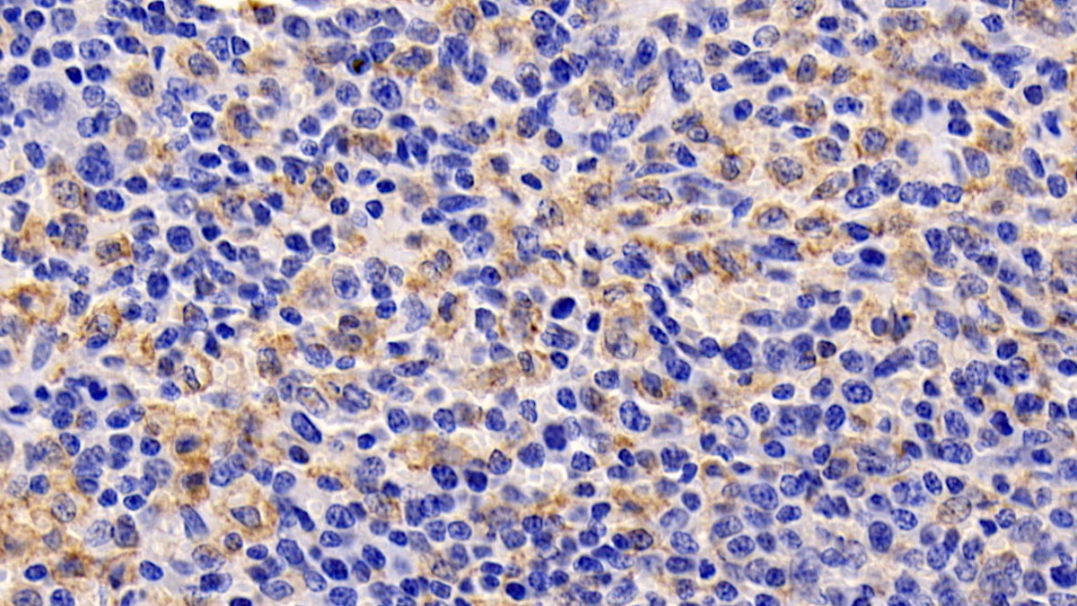 Monoclonal Antibody to Thymic Stromal Lymphopoietin (TSLP)