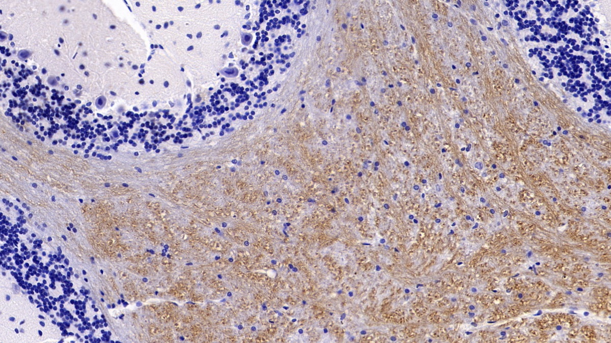 Monoclonal Antibody to Microtubule Associated Protein 2 (MAP2)