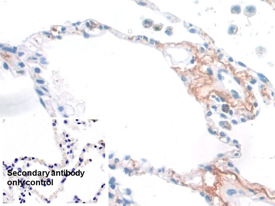 Monoclonal Antibody to Elastin (ELN)