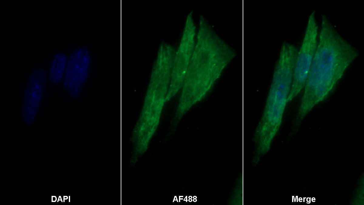 Monoclonal Antibody to Elastin (ELN)