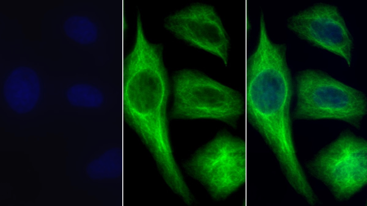 Monoclonal Antibody to Beta Actin (ACTB)