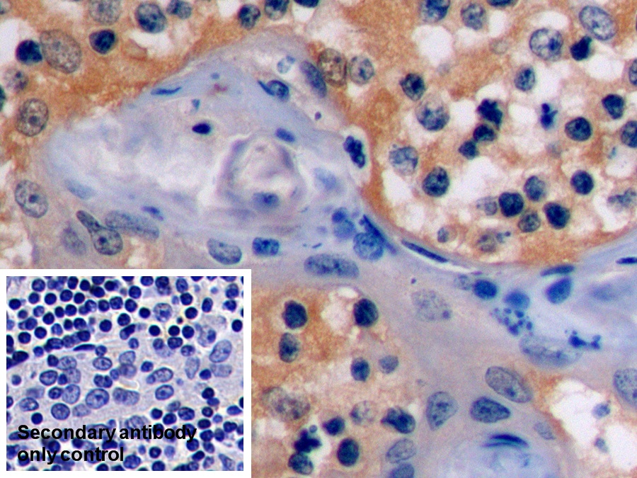 Monoclonal Antibody to Beta Actin (ACTB)