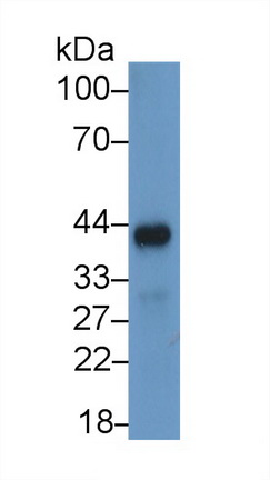 Monoclonal Antibody to Beta Actin (ACTB)