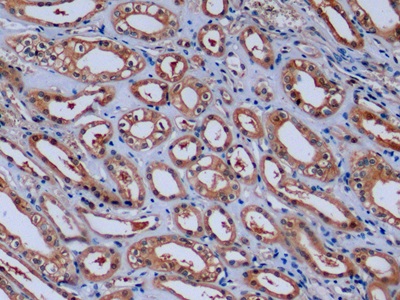 Monoclonal Antibody to Beta Actin (ACTB)