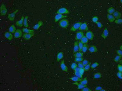 Monoclonal Antibody to Beta Actin (ACTB)