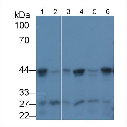 Monoclonal Antibody to Beta Actin (ACTB)