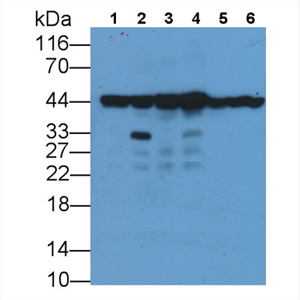 Monoclonal Antibody to Beta Actin (ACTB)