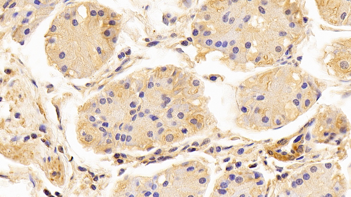 Monoclonal Antibody to Beta Actin (ACTB)