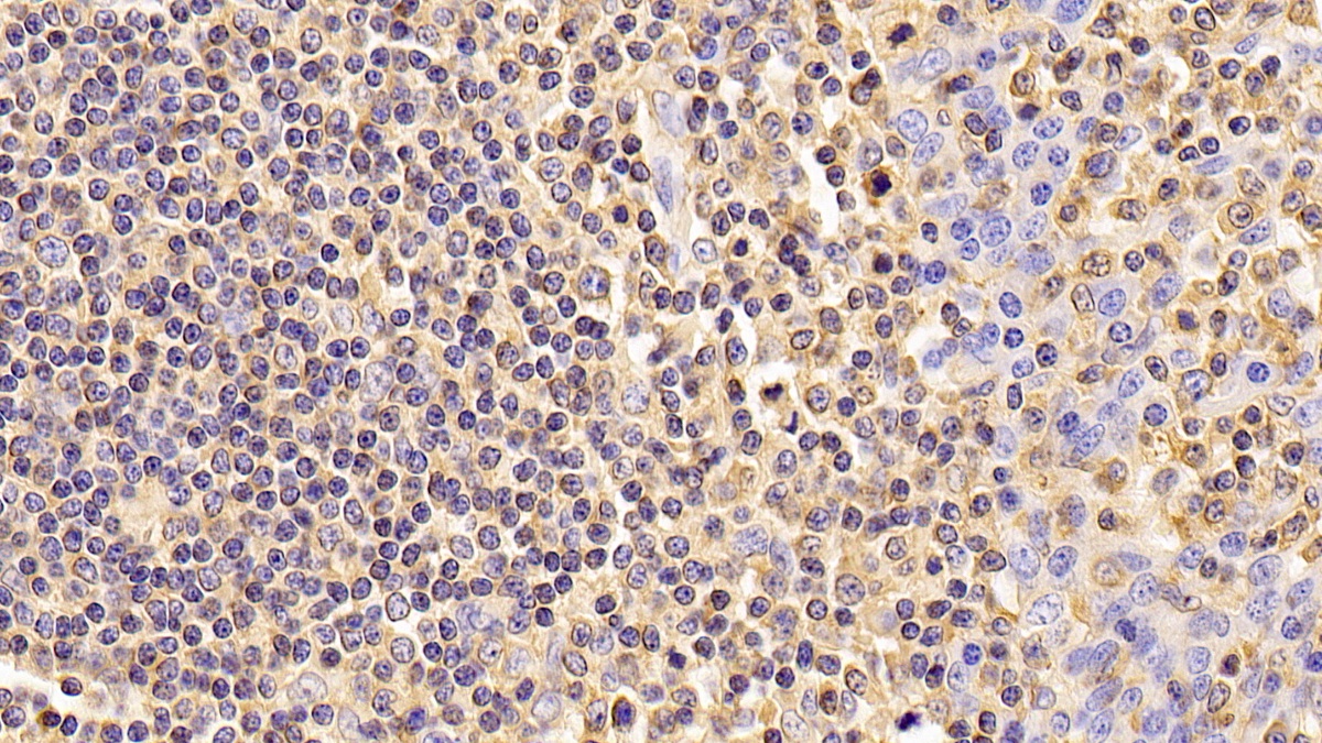 Monoclonal Antibody to Beta Actin (ACTB)