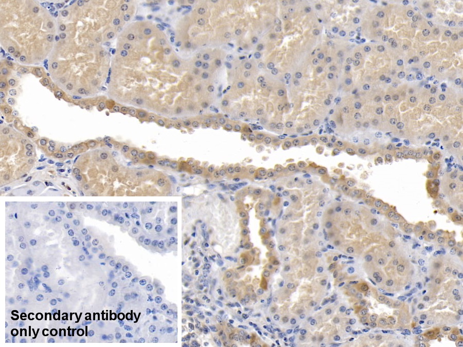 Monoclonal Antibody to Beta Actin (ACTB)