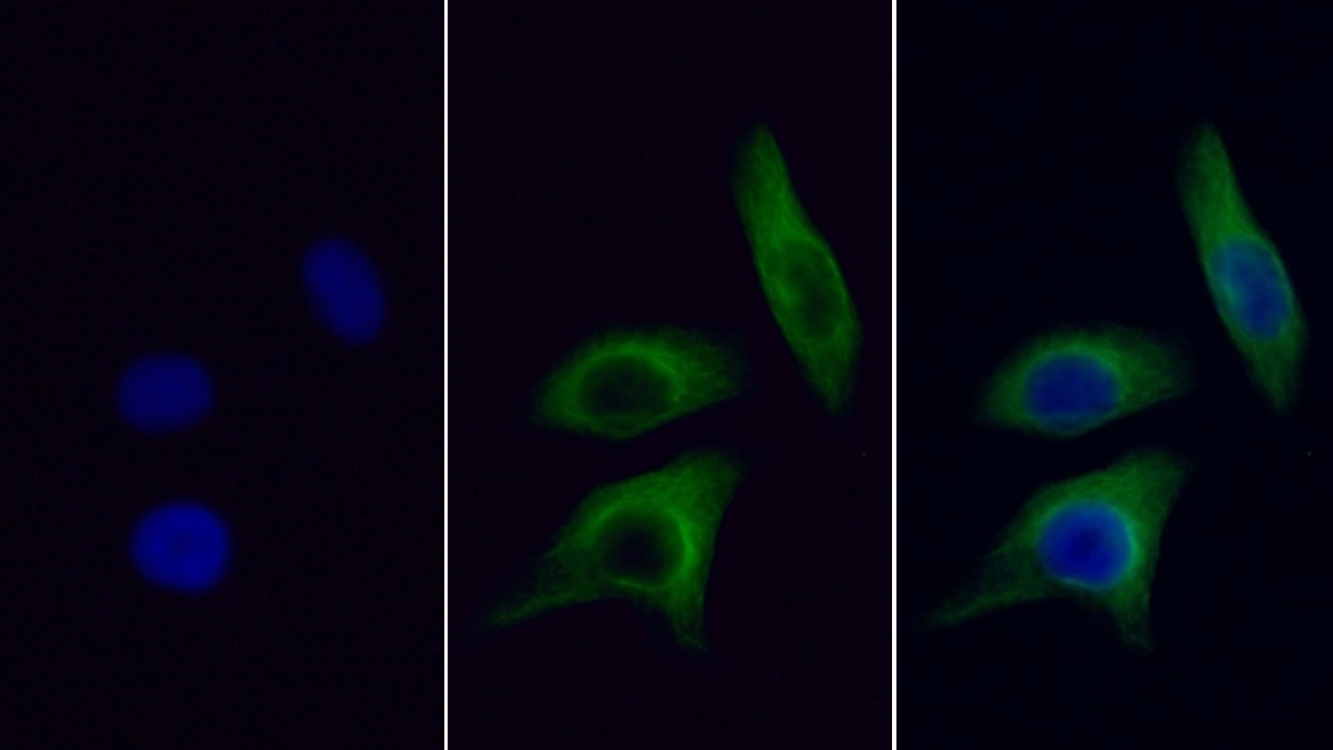 Monoclonal Antibody to Beta Actin (ACTB)