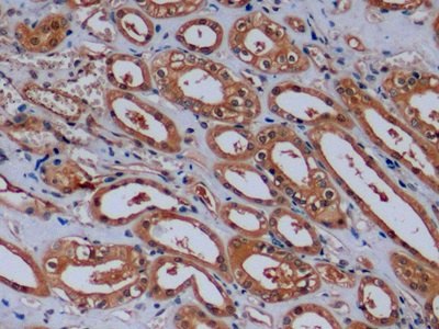 Monoclonal Antibody to Beta Actin (ACTB)