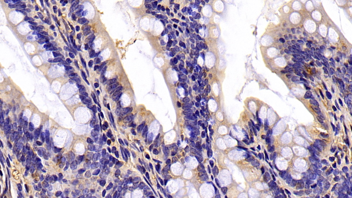 Monoclonal Antibody to Beta Actin (ACTB)