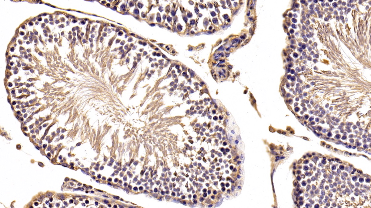 Monoclonal Antibody to Beta Actin (ACTB)