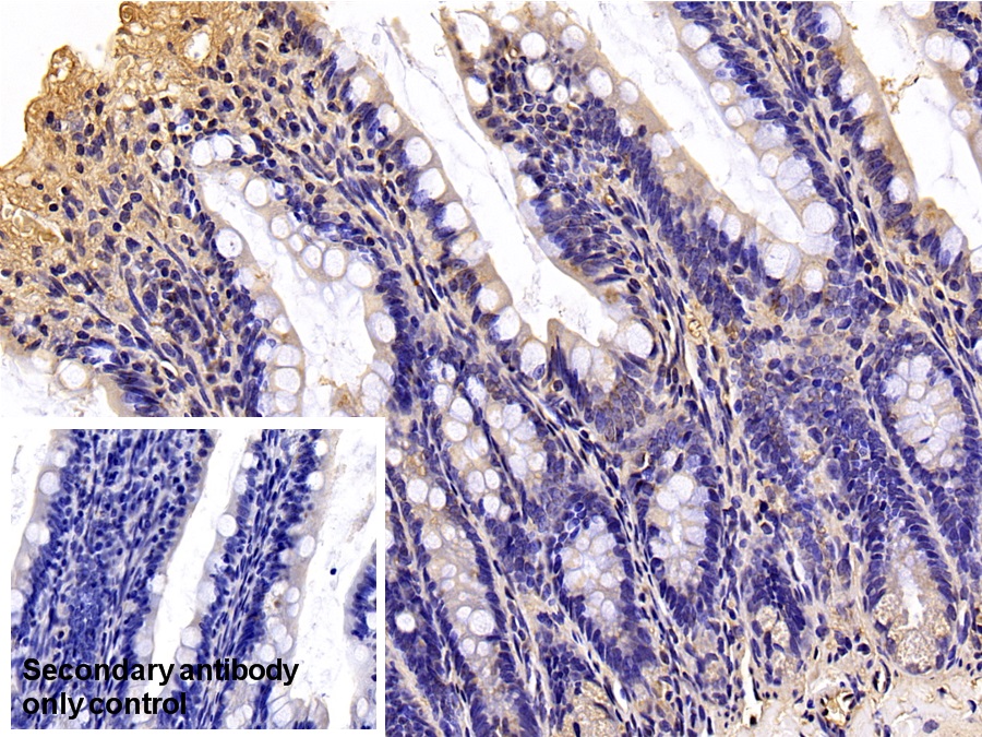 Monoclonal Antibody to Beta Actin (ACTB)