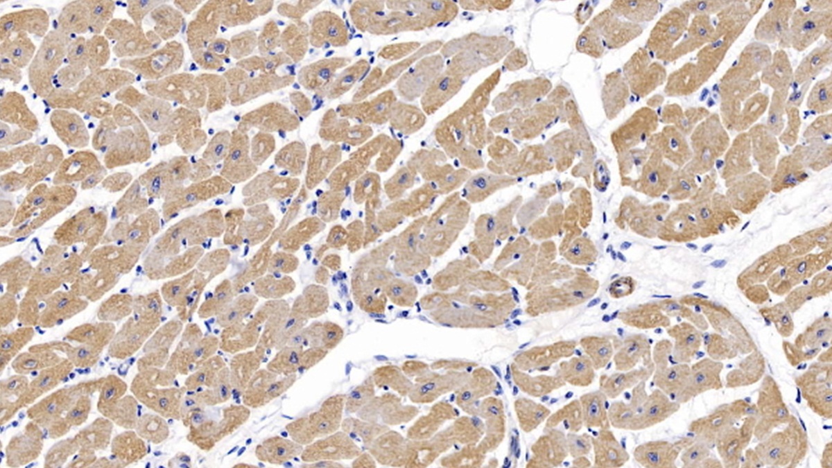 Monoclonal Antibody to Actin Alpha 1, Cardiac Muscle (ACTC1)