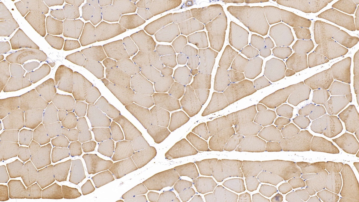 Monoclonal Antibody to Actin Alpha 1, Cardiac Muscle (ACTC1)