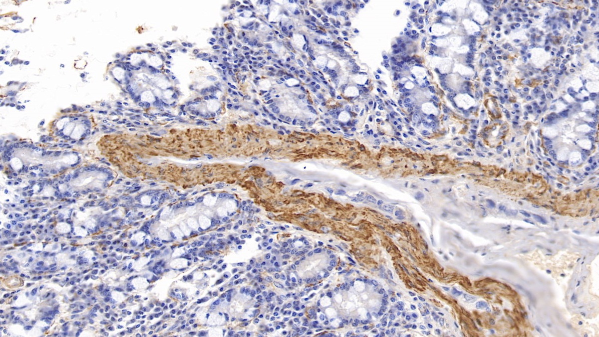 Monoclonal Antibody to Actin Alpha 1, Cardiac Muscle (ACTC1)