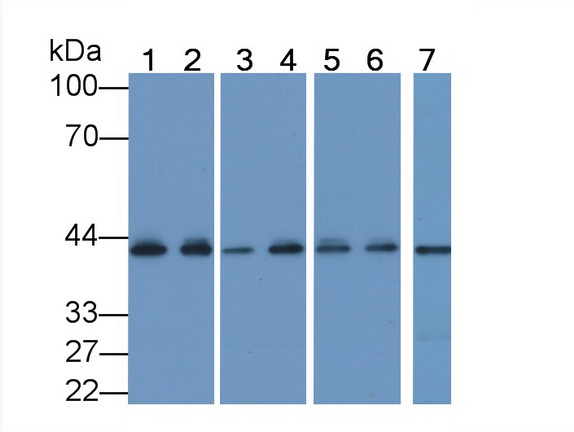 Monoclonal Antibody to Actin Alpha 1, Cardiac Muscle (ACTC1)