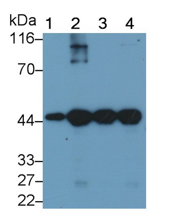 Monoclonal Antibody to Actin Alpha 1, Cardiac Muscle (ACTC1)