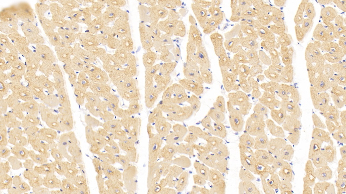 Monoclonal Antibody to Actin Alpha 1, Cardiac Muscle (ACTC1)