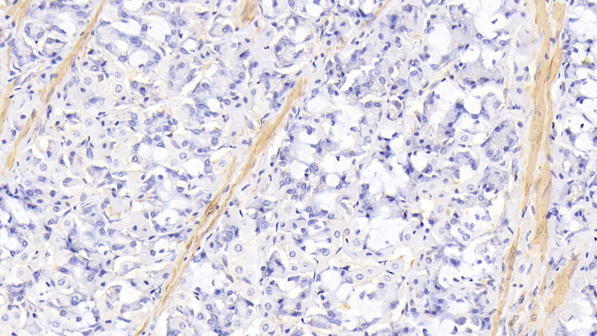 Monoclonal Antibody to Actin Alpha 1, Cardiac Muscle (ACTC1)